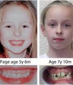 Naše zuby o nás vyprávějí příběh, aneb důležitost nikoliv rychlého, ale správného růstu dětí